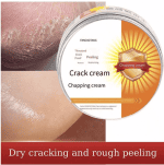 Κρέμα Ποδιών για Ξερά και Σκασμένα Πόδια
